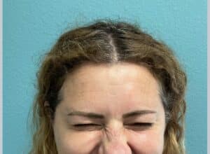 After Image: Neurotoxin