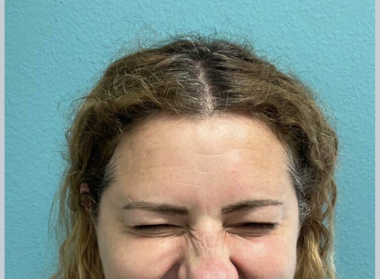 After Image: Neurotoxin - front