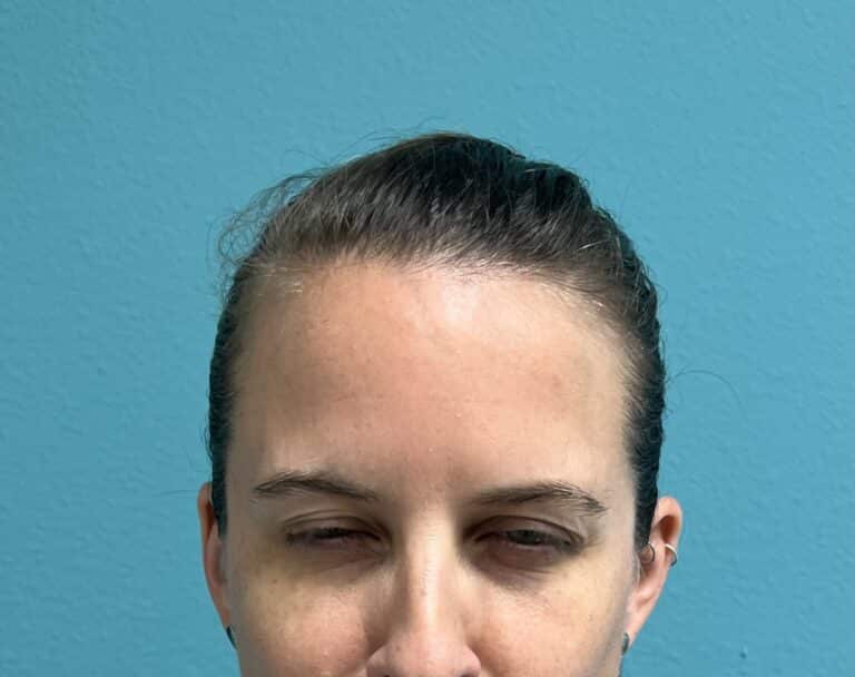 After Image: Neurotoxin - front