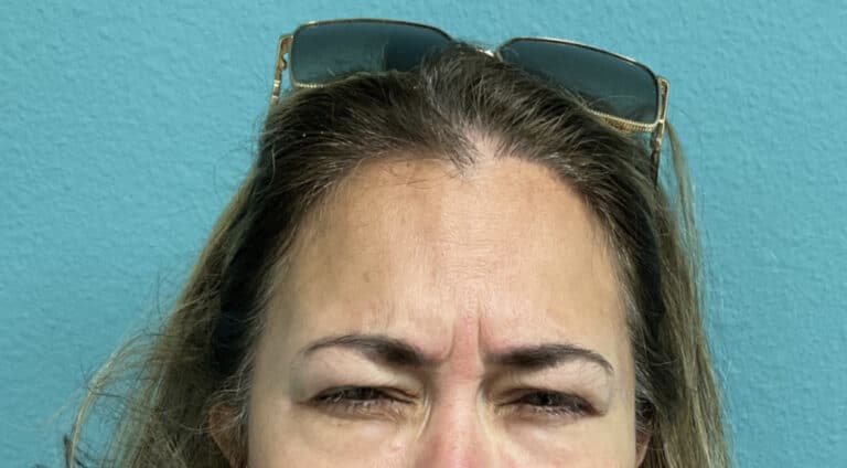 Before Image: Neurotoxin - front