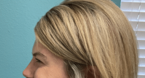 After Image: Neurotoxin