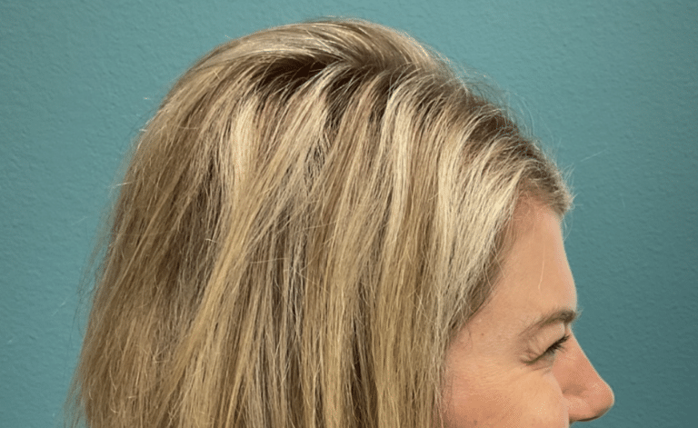 After Image: Neurotoxin - right-side