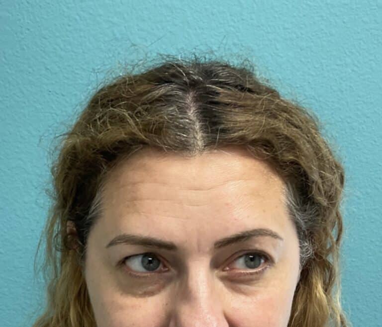 After Image: Neurotoxin - front