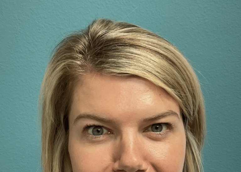 After Image: Neurotoxin - front