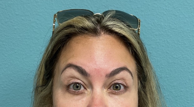 After Image: Neurotoxin - front