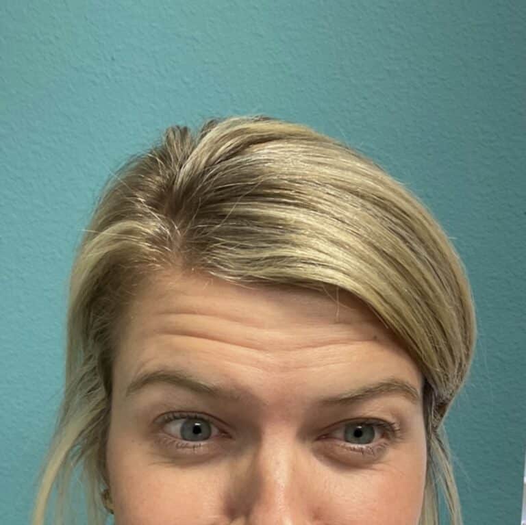 Before Image: Neurotoxin - front