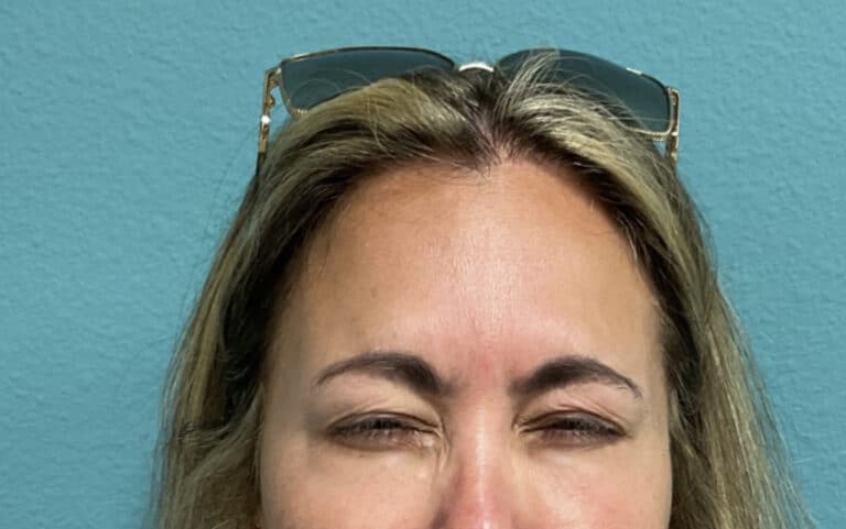 After Image: Neurotoxin - front